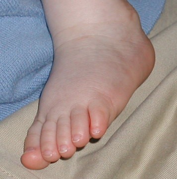 Sleeping foot